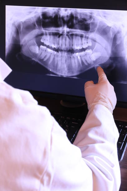Best Emergency Tooth Extraction in South Browning, MT