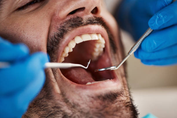 Best Emergency Dental Care for Trauma or Injury in South Browning, MT
