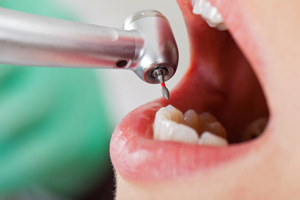 Best Emergency Broken Tooth Repair in South Browning, MT